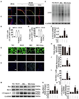 Liraglutide via Activation of AMP-Activated Protein Kinase-Hypoxia Inducible Factor-1α-Heme Oxygenase-1 Signaling Promotes Wound Healing by Preventing Endothelial Dysfunction in Diabetic Mice